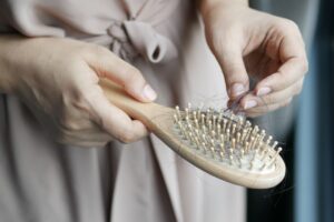 Best Hair Loss Treatments